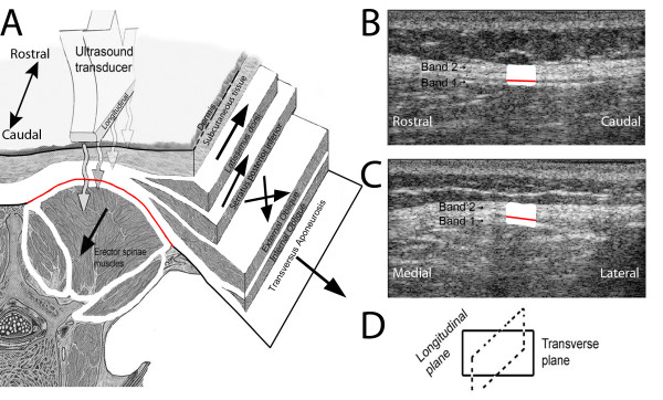 Ultrasound-imaging-of-thoracolumbar-fasc